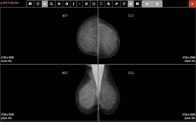 MMScreen Multi Window Opener from Chrome web store to be run with OffiDocs Chromium online MMScreen Multi Window Opener from Chrome web store to be run with OffiDocs Chromium online